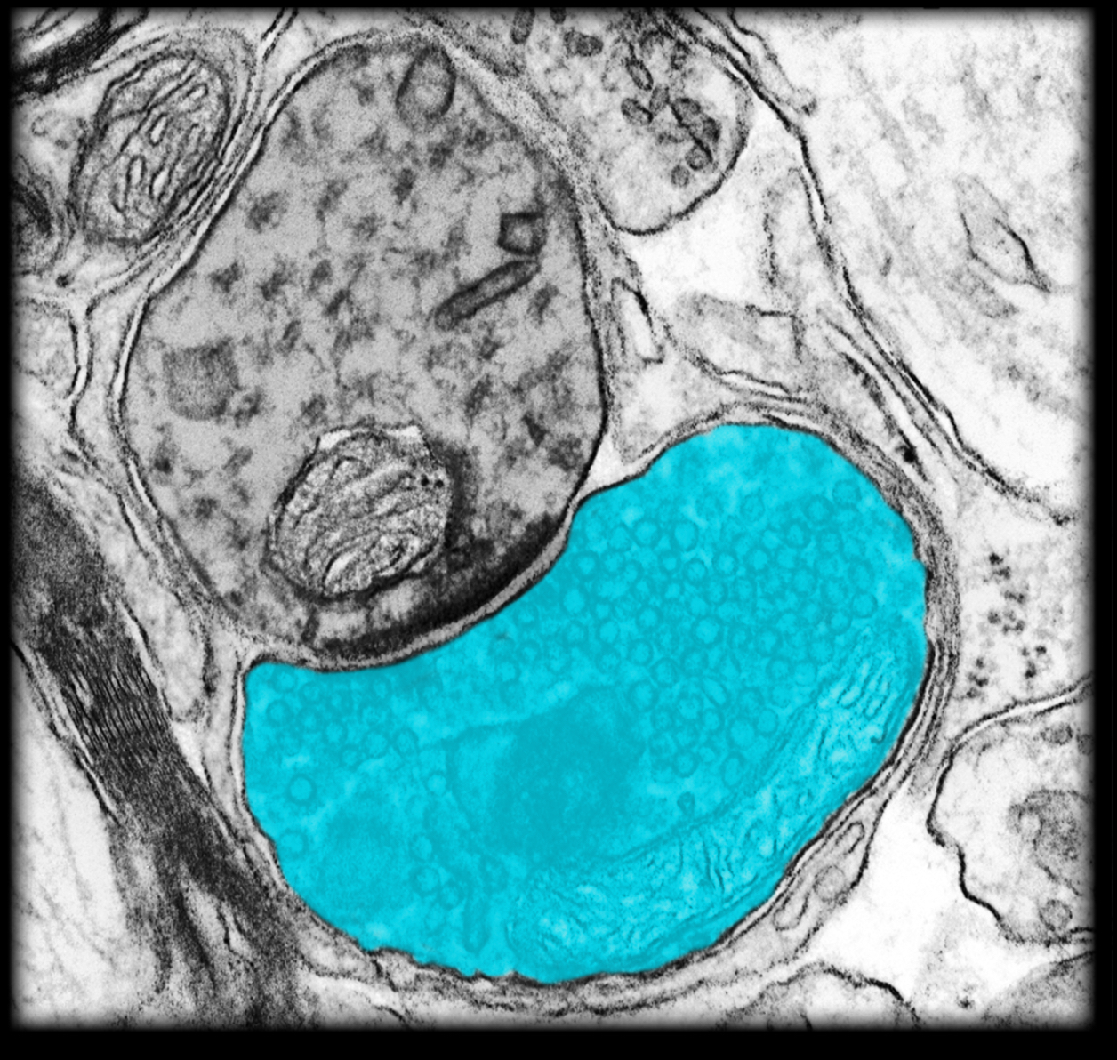<h4 collapsed="false" seolevelmigrated="true"><strong>Location:</strong></h4><ul><li><p>Distal end of axon</p></li></ul><h4 collapsed="false" seolevelmigrated="true"><strong>Description:</strong></h4><ul><li><p>Bulbous swelling containing synaptic vesicles</p></li><li><p>Contains presynaptic membrane</p></li><li><p>Contains mitochondria and synatic vesicles</p></li></ul><h4 collapsed="false" seolevelmigrated="true"><strong>Function:</strong></h4><ul><li><p>Delivers neuronal impulses to (chemical) synapse</p></li><li><p>Accumulates and recycles synaptic vesicles (containing neurotransmitter)</p></li></ul><h4 collapsed="false" seolevelmigrated="true"><strong>Comment:</strong></h4><ul><li><p>Presynaptic terminal is unmyelinated</p></li></ul>