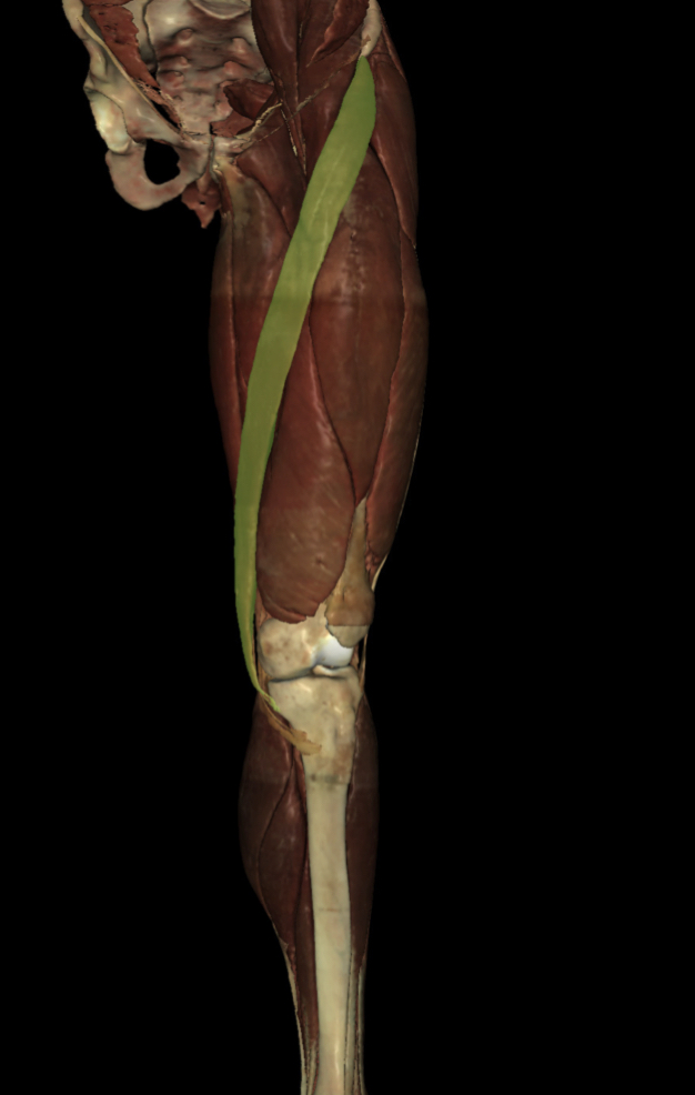 <p>Identify the Structure</p>