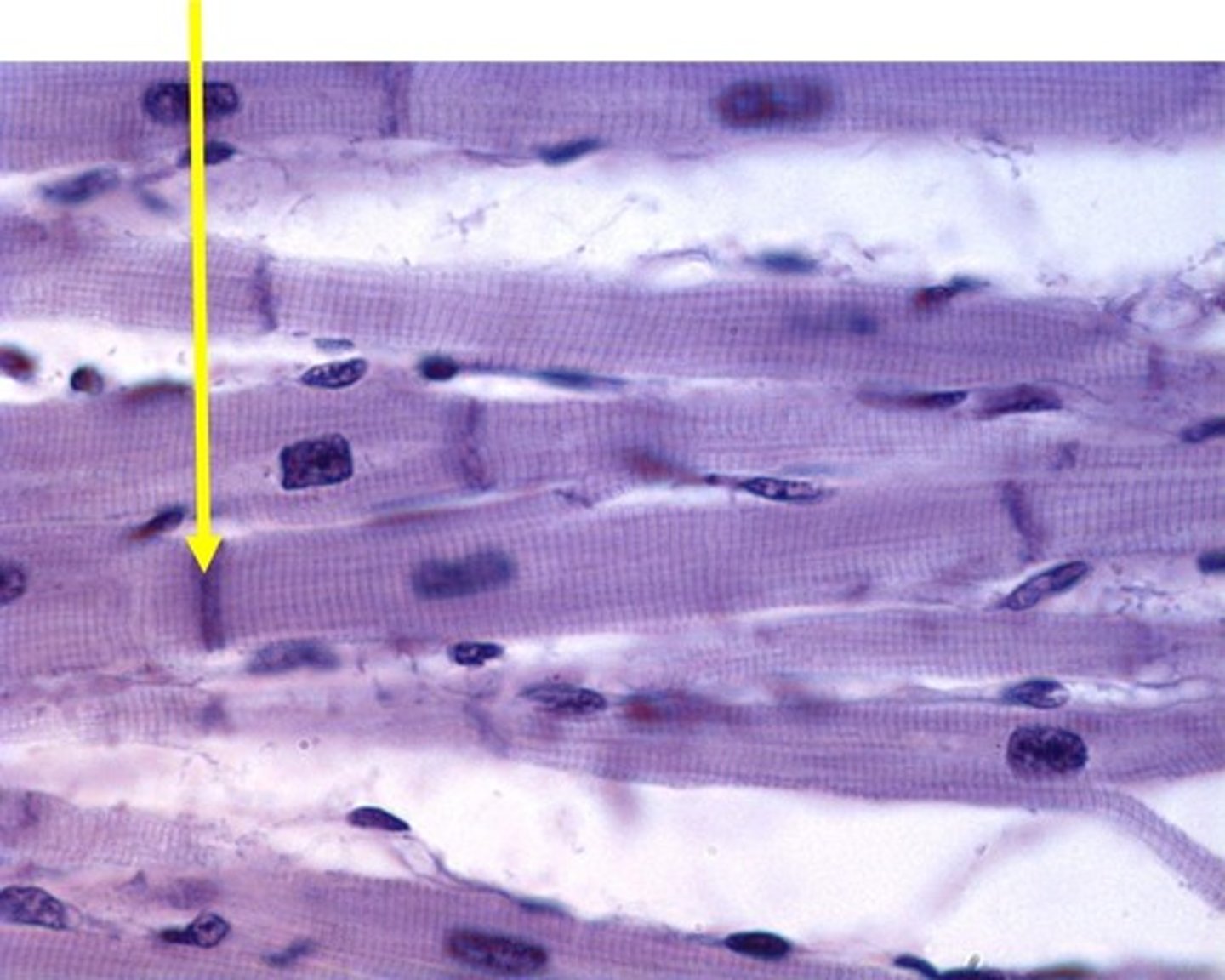 <p>what component of muscle tissue is this</p>