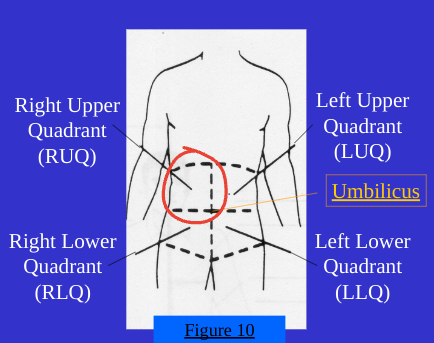 <ol><li><p>Right Upper Quad(RUQ)</p></li></ol><p></p>