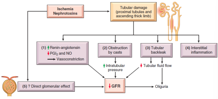 <ul><li><p>Accounts for ~50% of AKI cases in hospitalized patients</p></li><li><p>Tubular epithelial cells are very <strong>sensitive to ischemia and toxins</strong></p></li></ul><p></p>