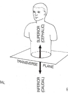 <p>aka horizontal, side-to-side, horizontal cut into upper and lower half</p>