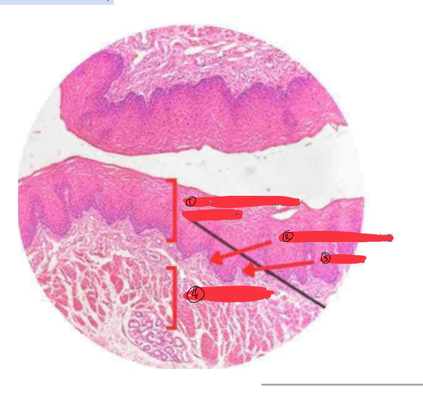 <p>Esophagus</p>