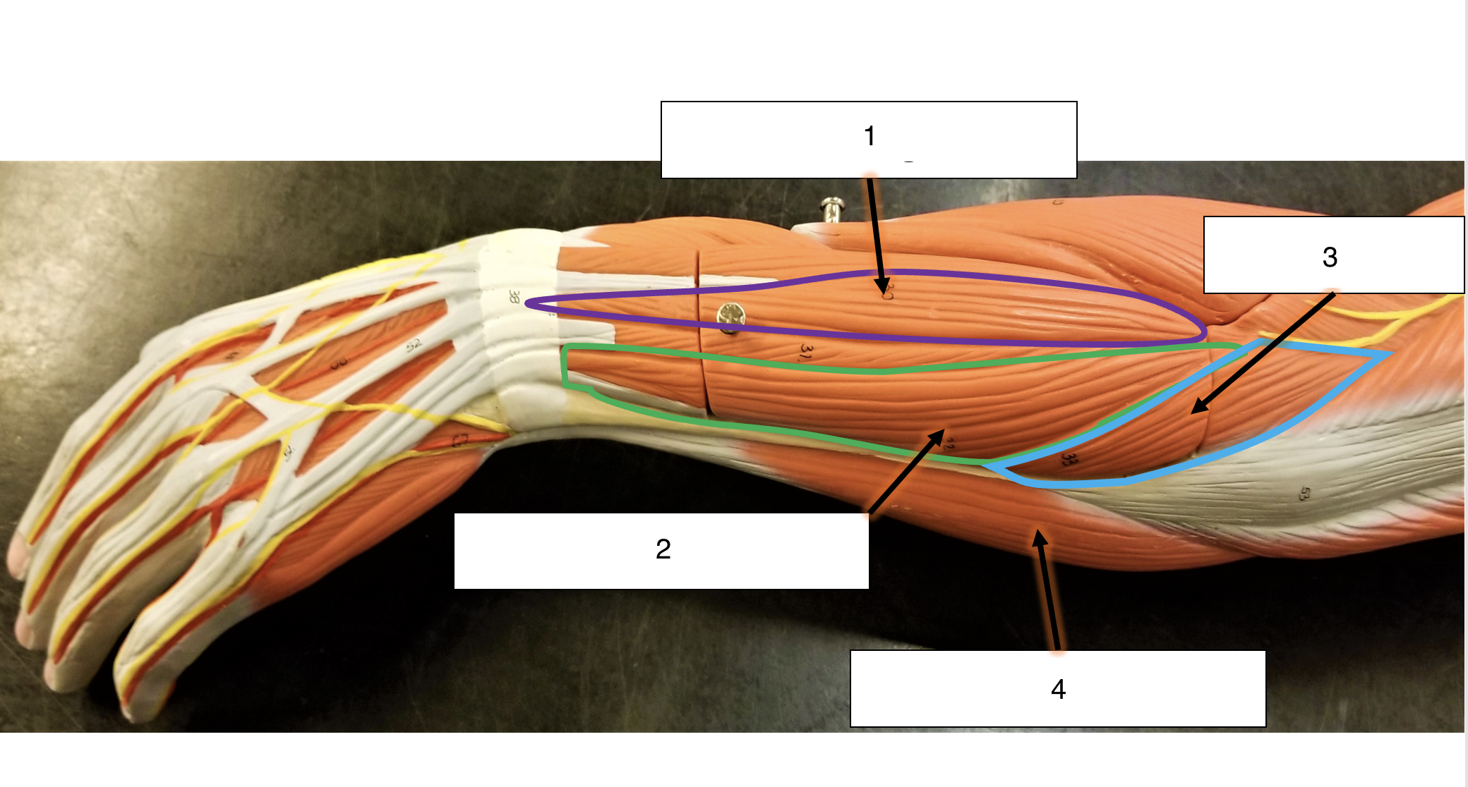 <p>name the muscle (3)</p>