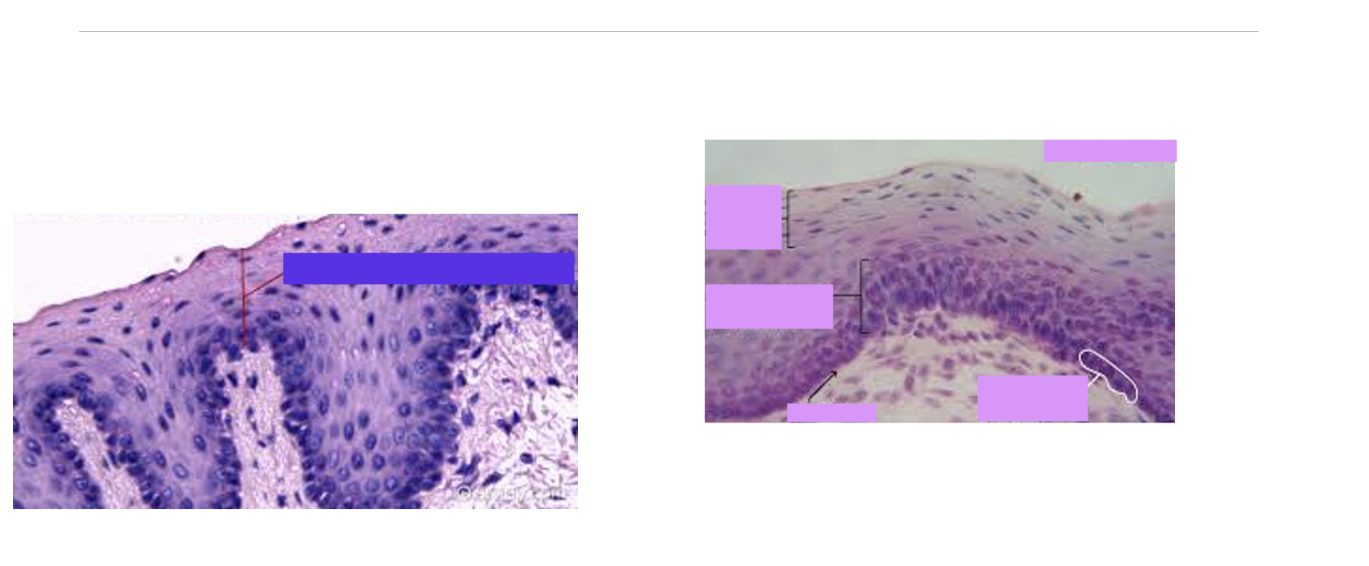 <p>What type of epithelial tissue?</p>