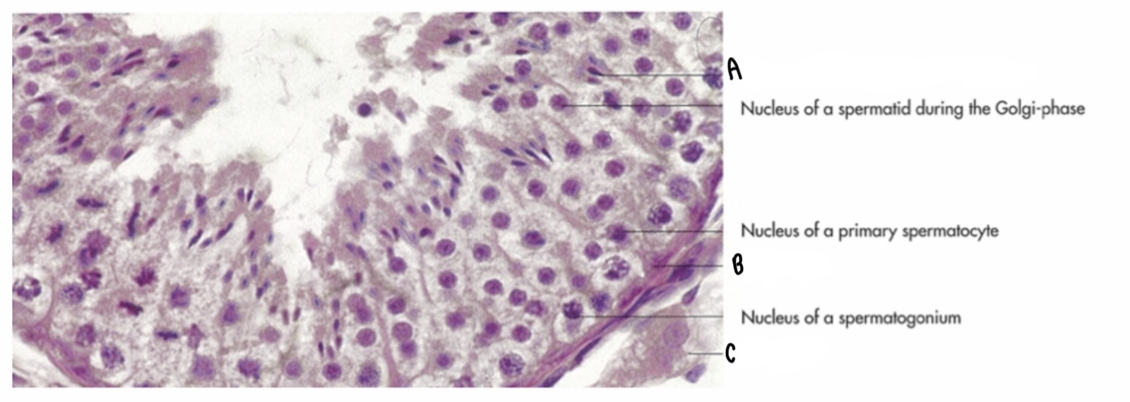 <p>What type of cell is labeled C?</p>
