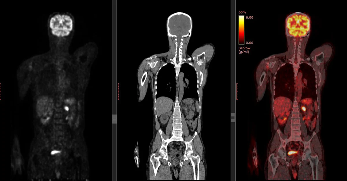 <p><span>Breakdown what <strong>PET/CT</strong> is a combination of (what each part specifically scans)</span></p>