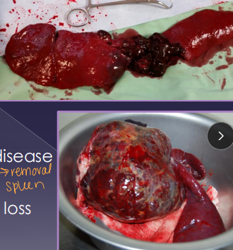 <p><span>Splenic Surgical Procedures</span></p>