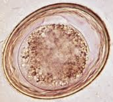 <p>Give the genius, species and common name for this parasitic egg</p>