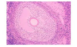 <p><span>Identify the stage of this follicle</span></p>