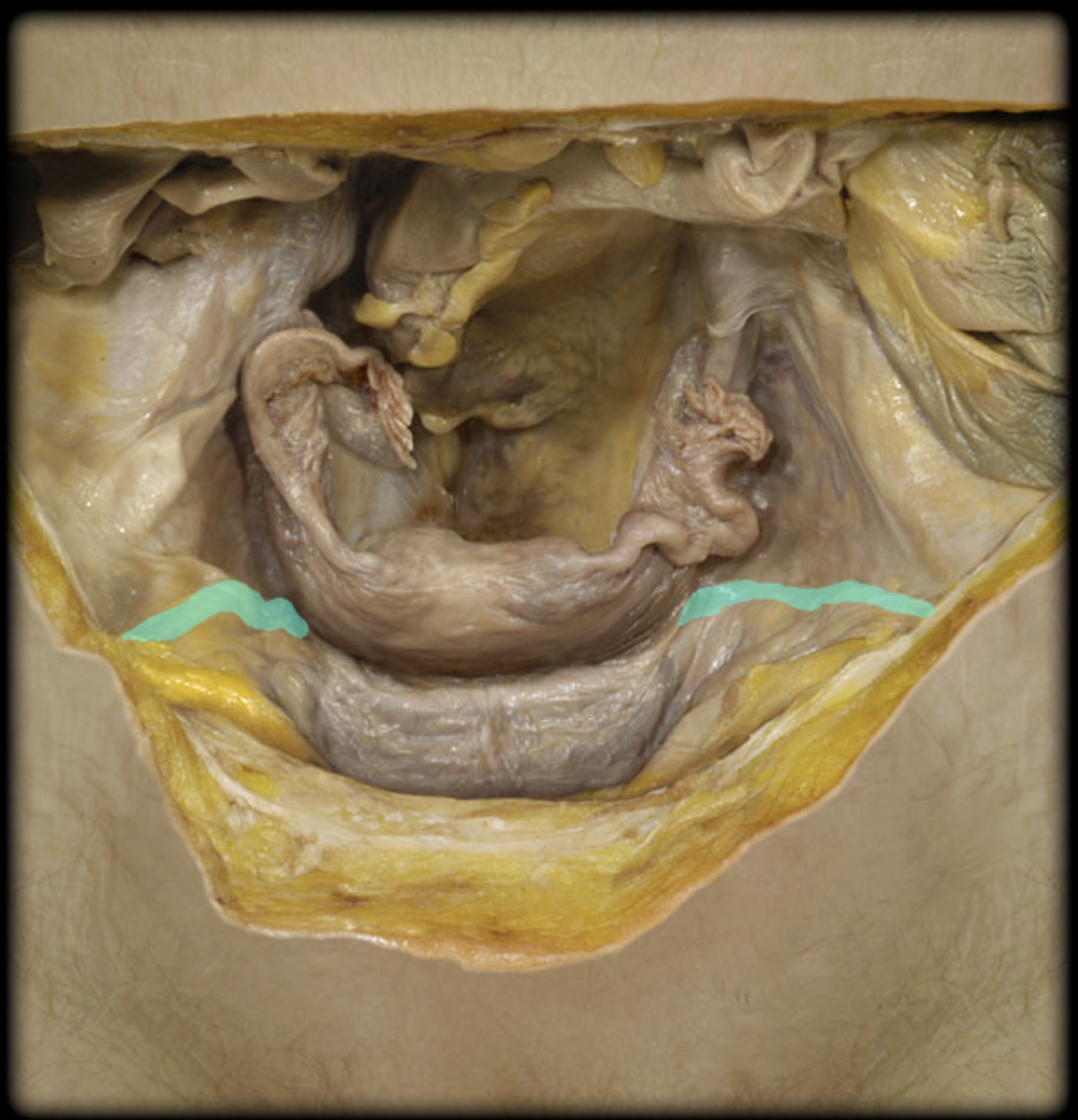 <p>What structure is shown?</p>