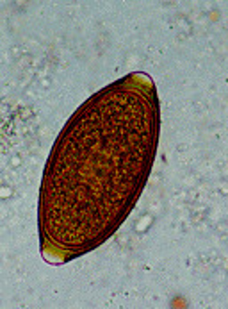 <p>Trichuris vulpis</p>