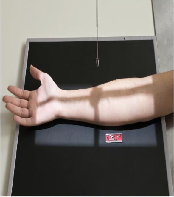 <p>Patient Position </p><p class="p1"><span data-name="black_small_square" data-type="emoji">▪</span><span style="line-height: normal;"><span> </span></span>Sitting at side or end of table</p><p class="p1"><span data-name="black_small_square" data-type="emoji">▪</span><span style="line-height: normal;"><span> </span></span>Arm extended straight out from body with palm up</p><p class="p1"><span data-name="black_small_square" data-type="emoji">▪</span><span style="line-height: normal;"><span> </span></span>Entire upper limb should be at same height</p><p class="p1"></p><p class="p1">Part Position</p><p class="p1"><span data-name="black_small_square" data-type="emoji">▪</span><span style="line-height: normal;"><span> </span></span>Place forearm on IR with hand supinated</p><p class="p1"><span data-name="black_small_square" data-type="emoji">▪</span><span style="line-height: normal;"><span> </span></span>Lean patient slightly laterally to place forearm in true AP</p><p class="p1"></p><p class="p1">CR</p><p class="p1"><span data-name="black_small_square" data-type="emoji">▪</span><span style="line-height: normal;"><span> </span></span>Perpendicular to mid-forearm</p><p class="p1"></p><p class="p1">Collimation</p><p class="p1"><span data-name="black_small_square" data-type="emoji">▪</span><span style="line-height: normal;"><span> </span></span>Include carpals and distal humerus</p><p class="p1"><span data-name="black_small_square" data-type="emoji">▪</span><span style="line-height: normal;"><span> </span></span>3-4 cm (1-1.5 in) of distal wrist and humerus included</p>