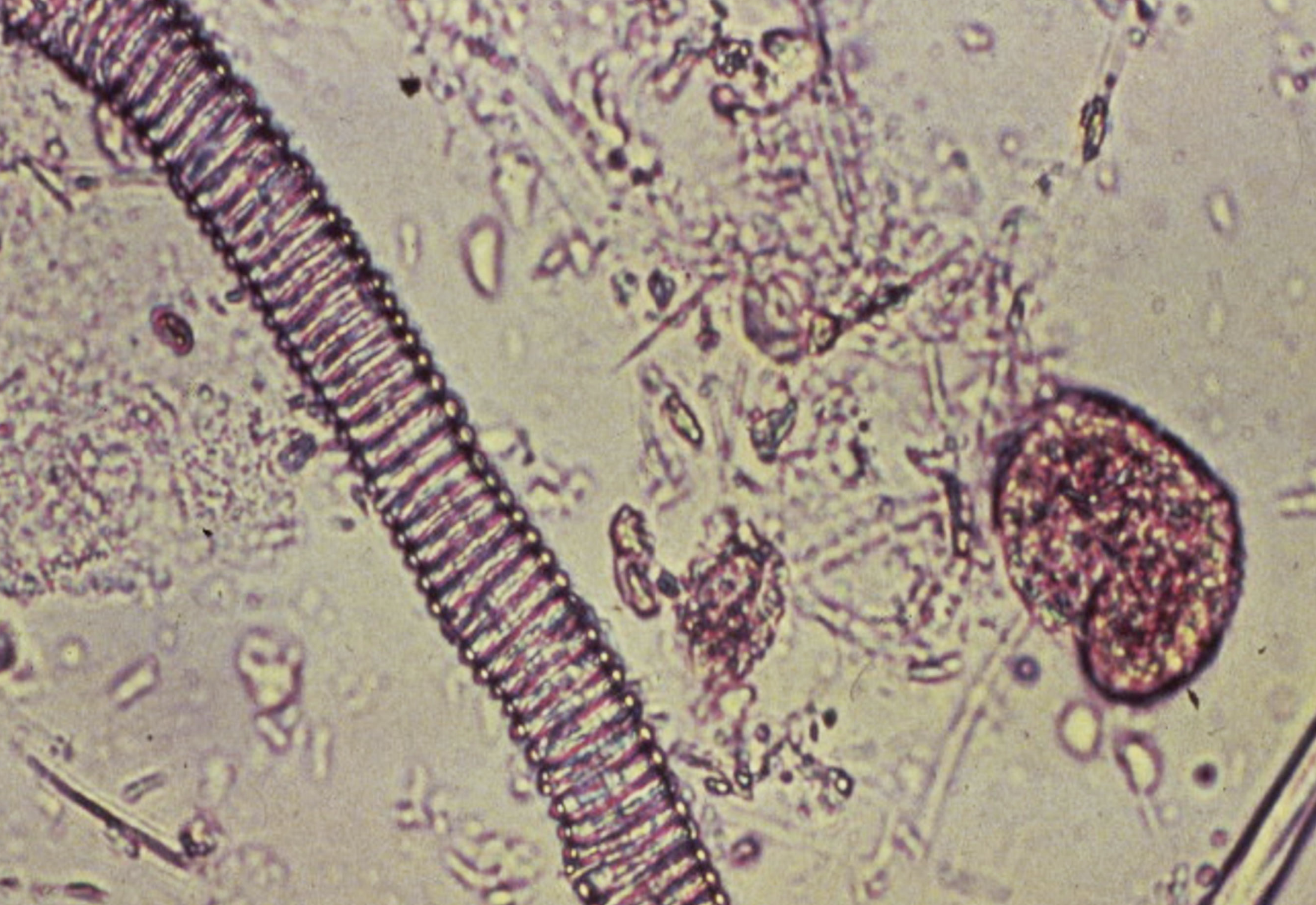 term image