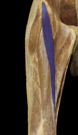 <p>narrow band, front of thigh, angled and superficial</p>