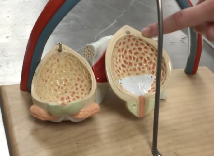 <p>Description: Smooth muscle layer of the urinary bladder</p><p>Relationship: When the urinary bladder expand, the parasympathetic nervous system stimulates the detrusor muscle to contract</p>