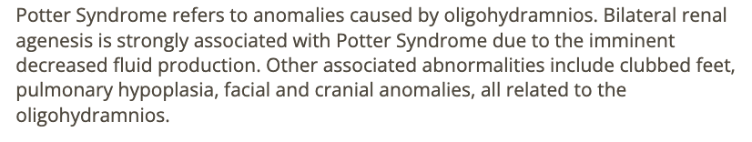 <p>d) potter</p>