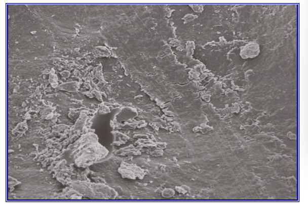 <p>Acid etch technique: removal of smear layer, high energy surface </p><p><strong>Dentine</strong>: dissolution of mineral phase, leaving exposed collagen network</p><p>excess water is removed - but not over dried - resin infiltration which forms the hybrid zone&nbsp;</p>