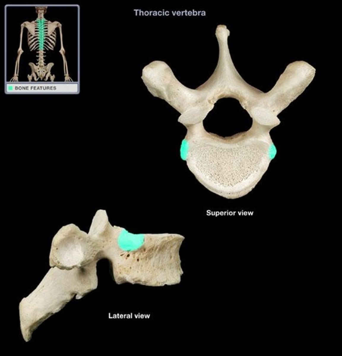 <p>half facet on superior and inferior edges of each vertebral body; articulates with head of ribs; also named superior and inferior costal facet of thoracic vertebra in APR</p>