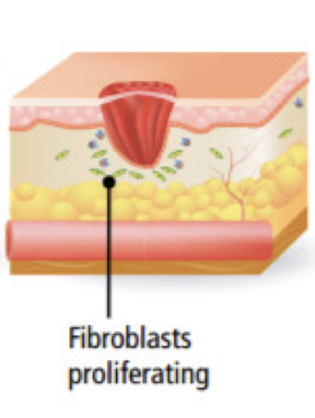 <p>What <strong>third</strong> <strong>phase</strong> of wound healing does <strong>angiogenesis, collagen deposition, granulation tissue formation, epithelialization, and wound contraction </strong>occur?</p>