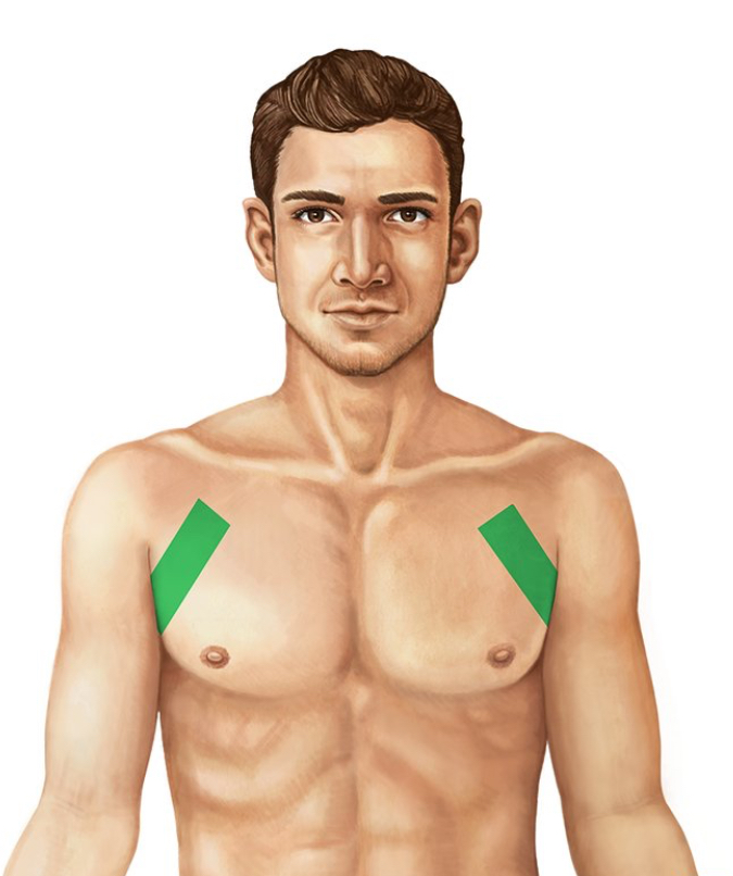 <p>Encompassing the armpit</p>