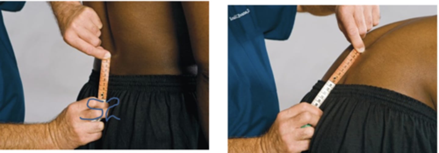 <p>Schober Test</p><p>- Which clinical condition would this test be positive?</p>