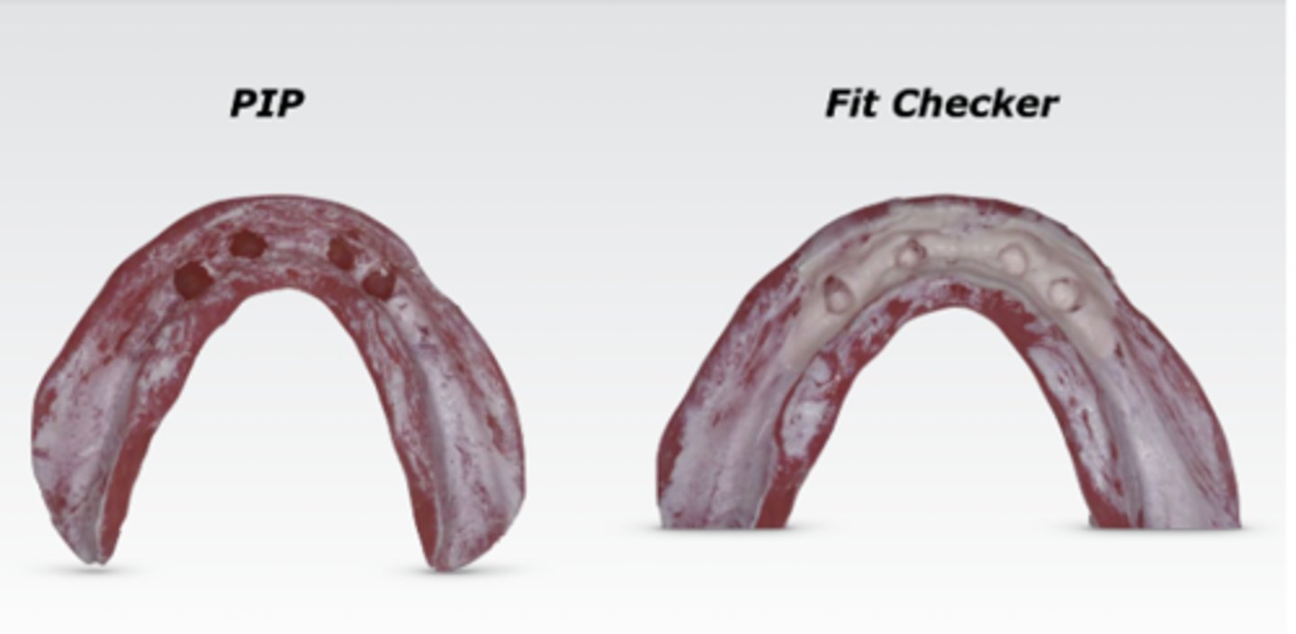 <p>The following figure is showing a denture adjustment for locator pick up procedure when you fabricate an implant supported locator retained overdenture. Based on the figure provided, please select the statement with the correct information. (Select one answer)</p><p>a. PIP should be used to make sure the housing space.</p><p>b. PIP should be used to make sure soft tissue adaptation.</p><p>c. Fit checker should be used to make sure soft tissue adaptation.</p><p>d. Fit checker should be used as an adhesive.</p><p>e. You can pick up locator without checking soft tissue adaptation.</p>