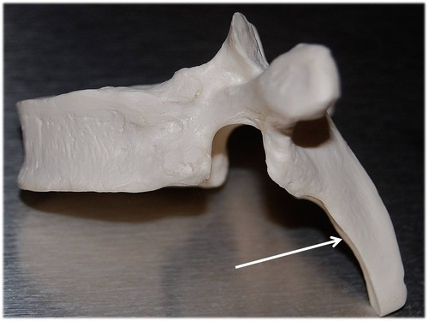 <p>Long, pointed, spine-like process that curves downward and is seen posteriorly</p>