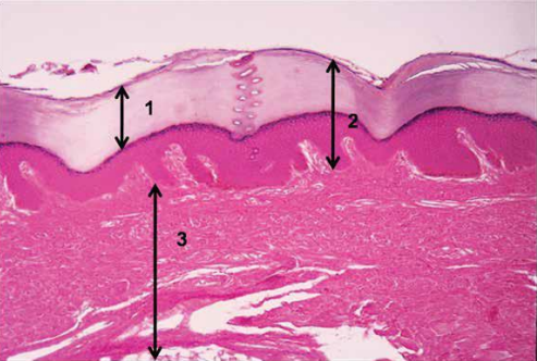 term image