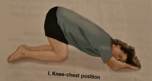 <p>Knee-Chest Position</p>