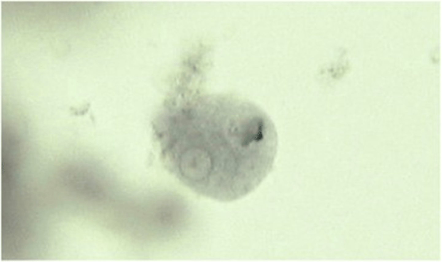 <p>This cyst form of ______________ is known to cause amoebic dysentery.</p>
