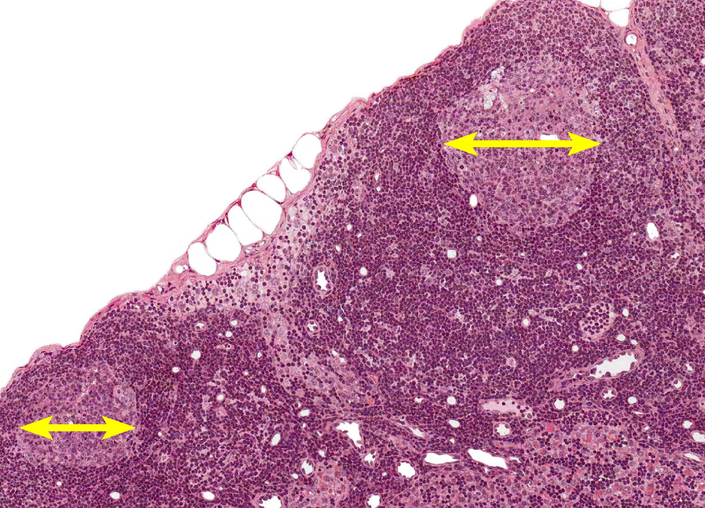 <p>center of the circular structure the <strong>lymphatic nodule</strong></p>