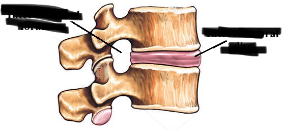 <p>intervertebral foramen</p>