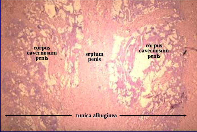 <p>Canine penis. </p><p>The figure shows at a slightly higher magnification the tunica albuginea septum penis, and corpus cavernosum penis.</p>