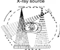 <p>2nd generation (fan beam)</p>