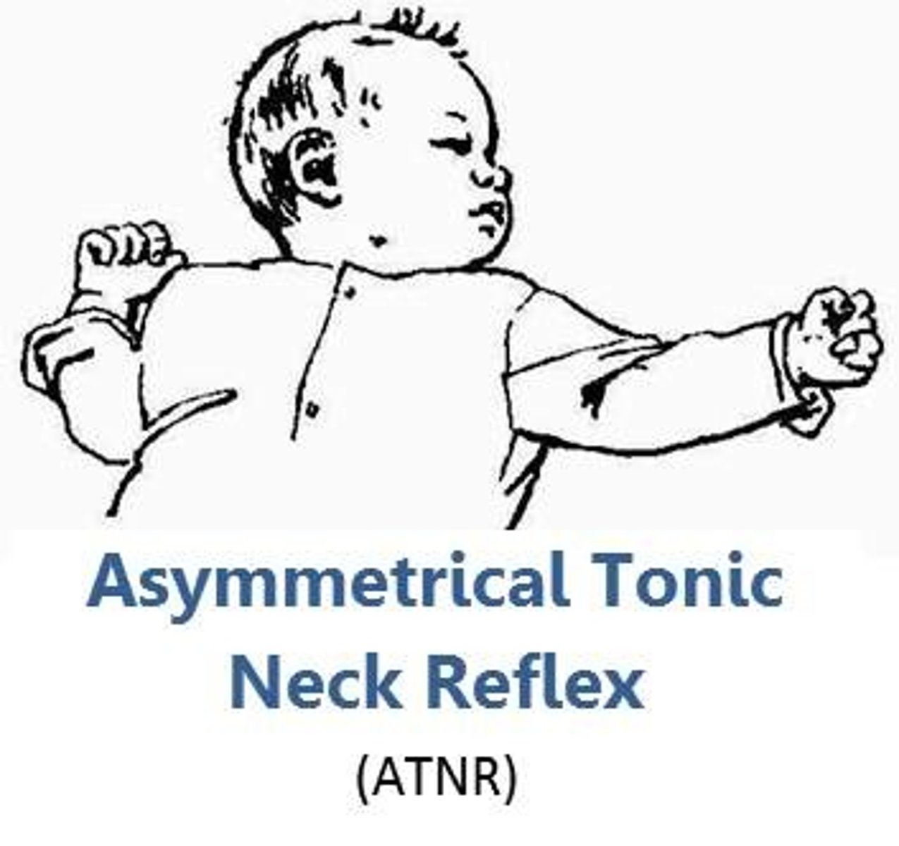 <p>ATN (Asymmetric tonic neck)</p>