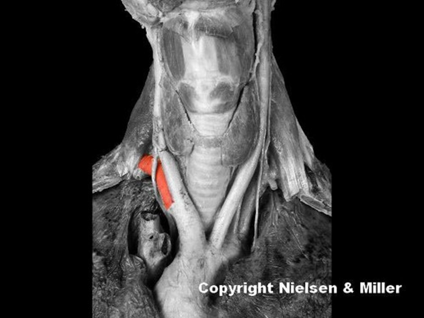 <p>Identify the highlighted vessel.</p>