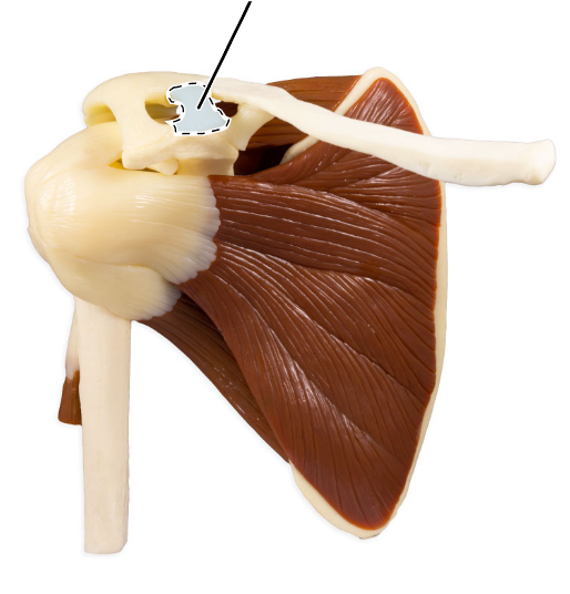 <p>What ligament is highlighted here?</p>