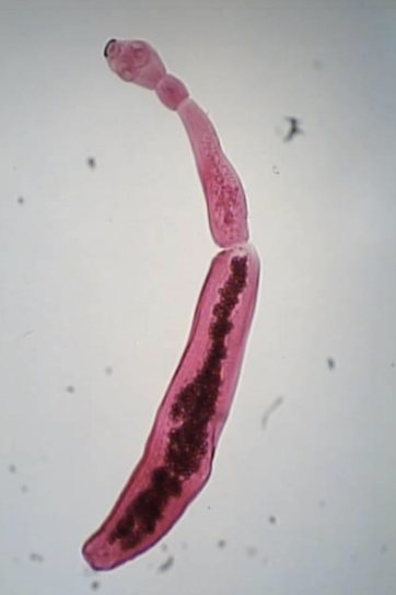 <p>Echinococcus granulosus </p>