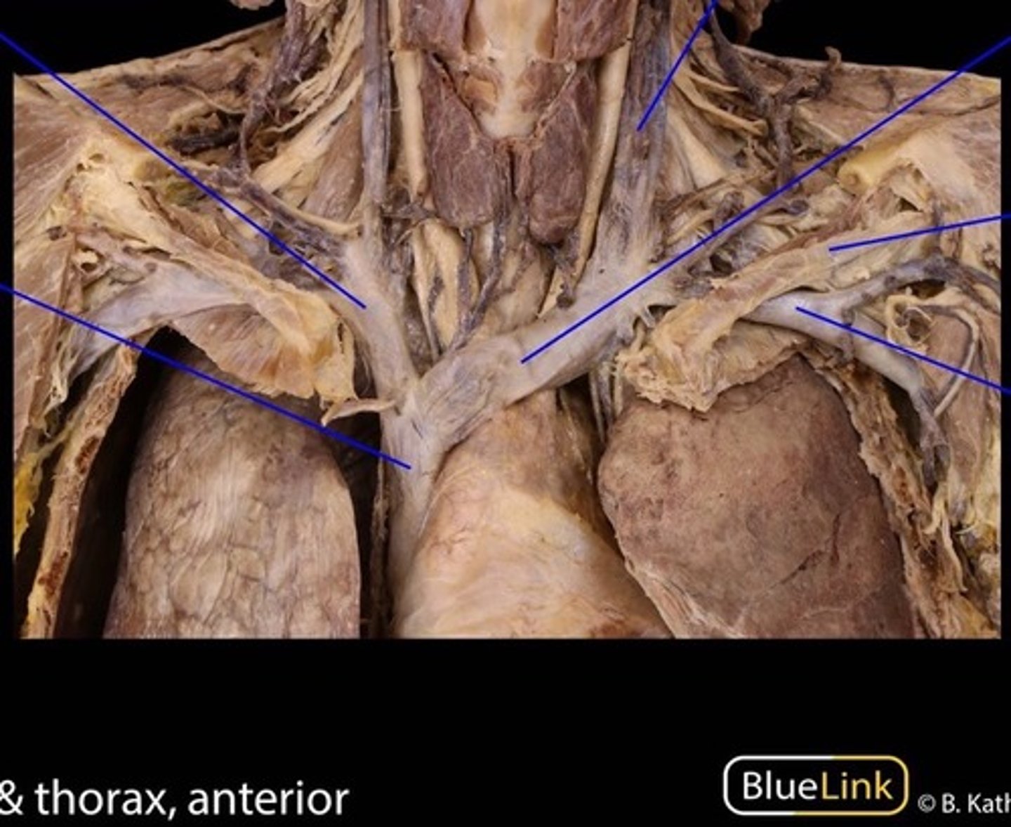 <p>bottom left line</p>