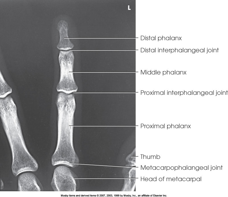 <p>What position is demonstrated?</p>