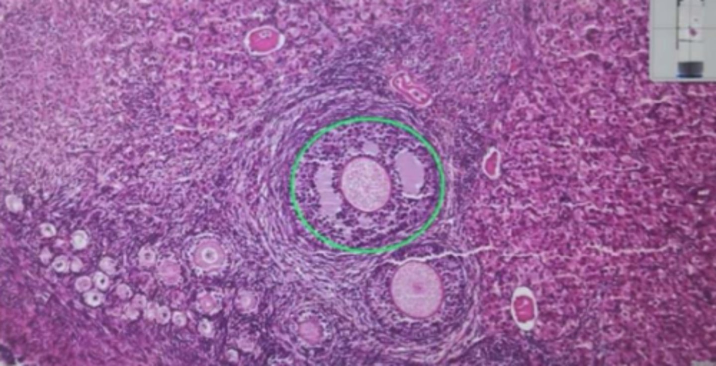 <p>What type of follice can be seen in the following image?</p><p>a) Primary follicle</p><p>b) Secondary follicle</p><p>c) Primary</p><p>d) Tertiary follicle</p>