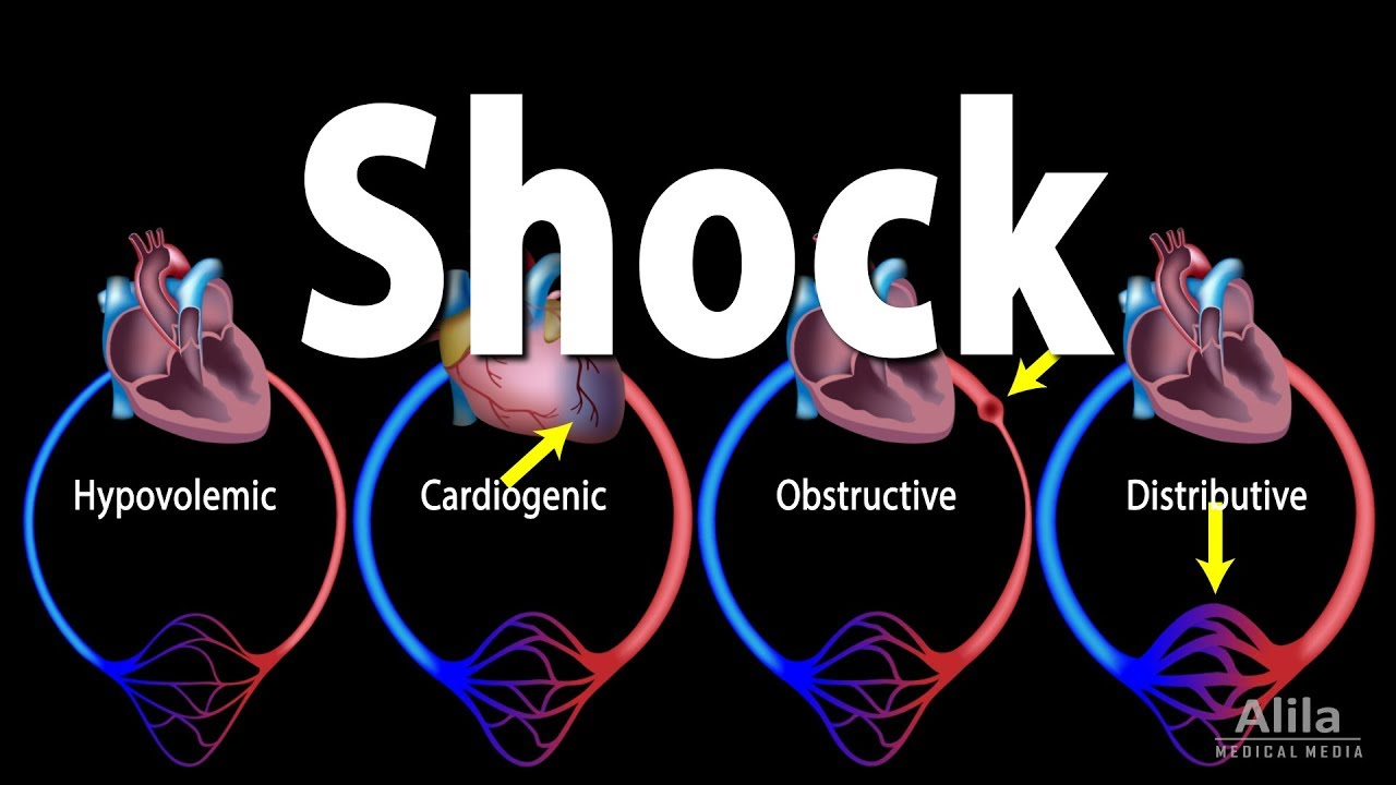 <p>__ shock is due to inadequate blood flow to meet tissue needs</p>