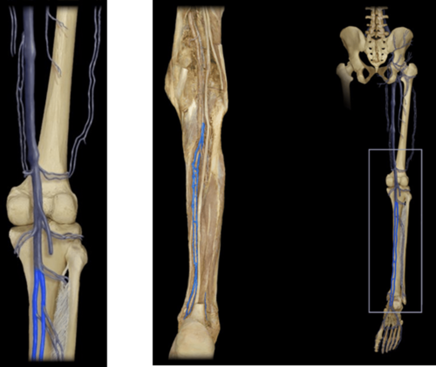 <p>Name this vessel.</p>