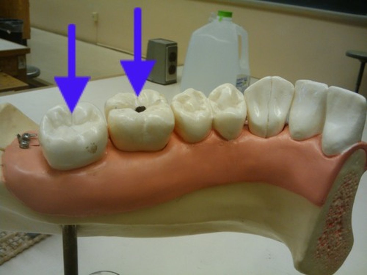 <p>Back teeth that grind food; bicuspid or multicuspid</p>