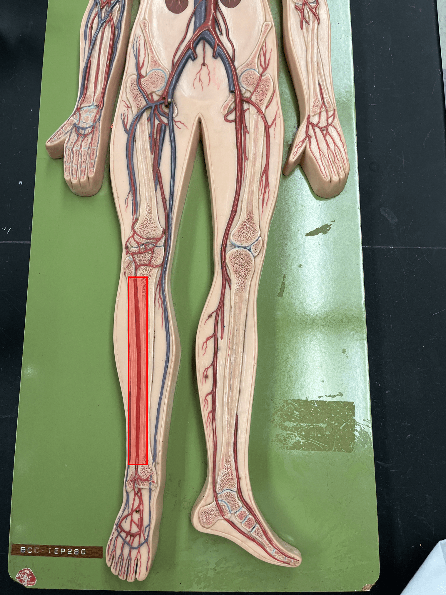 <p>• An artery of the lower limb.</p>
<p>• Originates from the popliteal artery.</p>
<p>• Supplies the anterior lower leg muscles.</p>