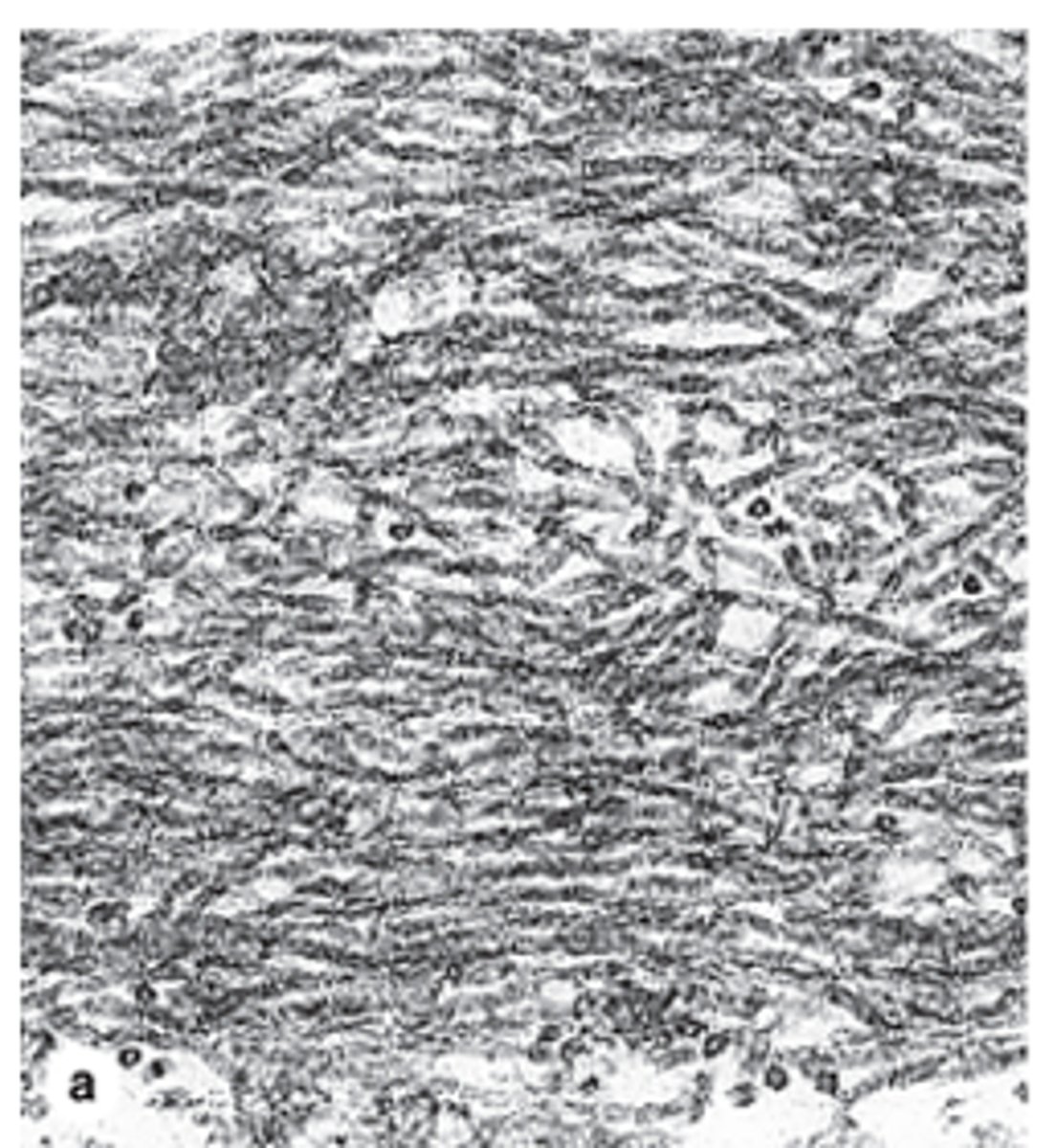 <p>Which cells secrete elastic fibers? (2)</p>
