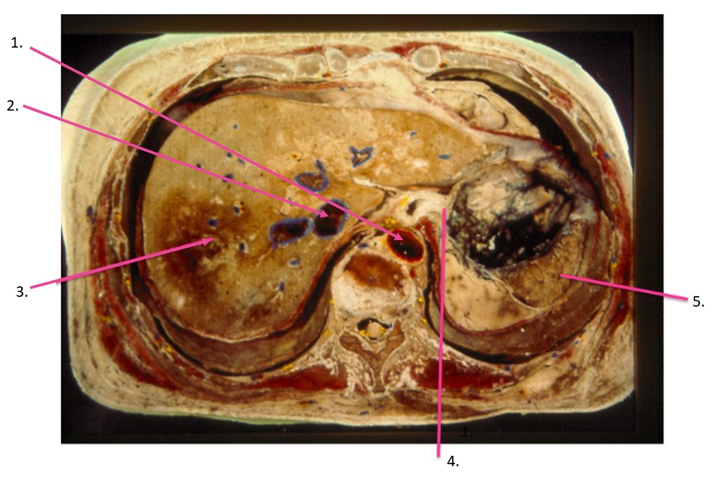 <p>identify 1</p>