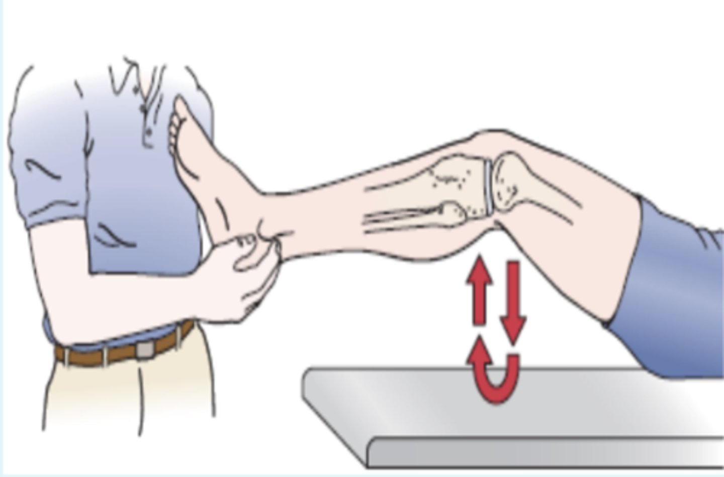 <p>- meniscal</p><p>Procedure:</p><p>- The patient lies in the supine position, and the heel of the patient's foot is cupped in the examiner's hand. The patient's knee is completely flexed, and the knee is passively allowed to extend. If extension is not complete or has a rubbery end feel ("springy block"), there is something blocking full extension.</p><p>(+): most likely cause of block is a torn meniscus</p>