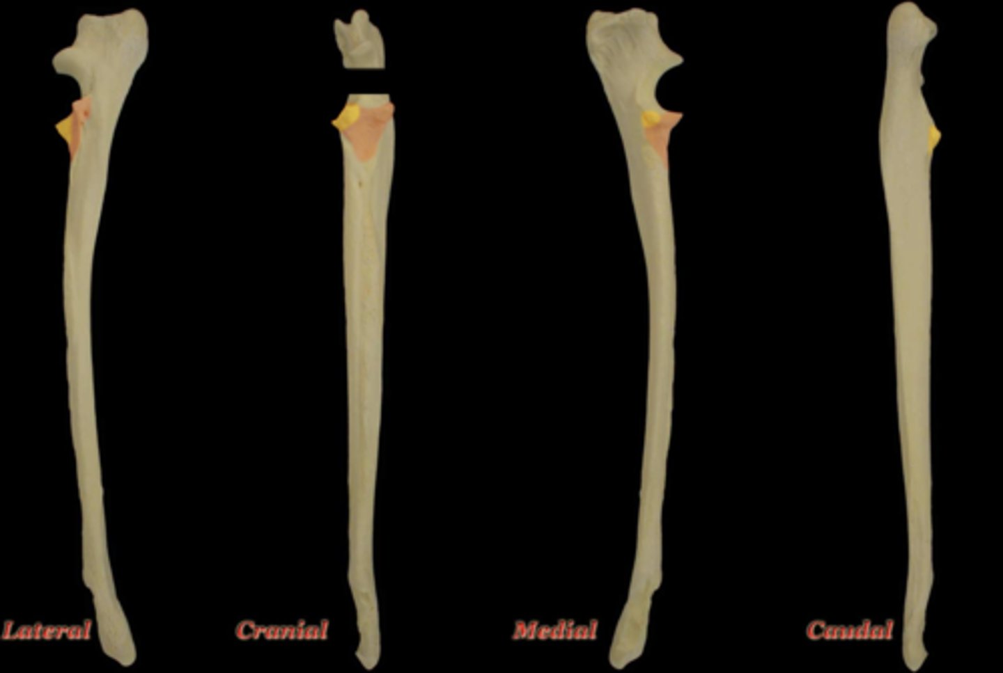 <p>What structure is highlighted in yellow in this picture?</p>